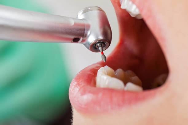 Best Dentist for Dental Trauma  in Saginaw, TX